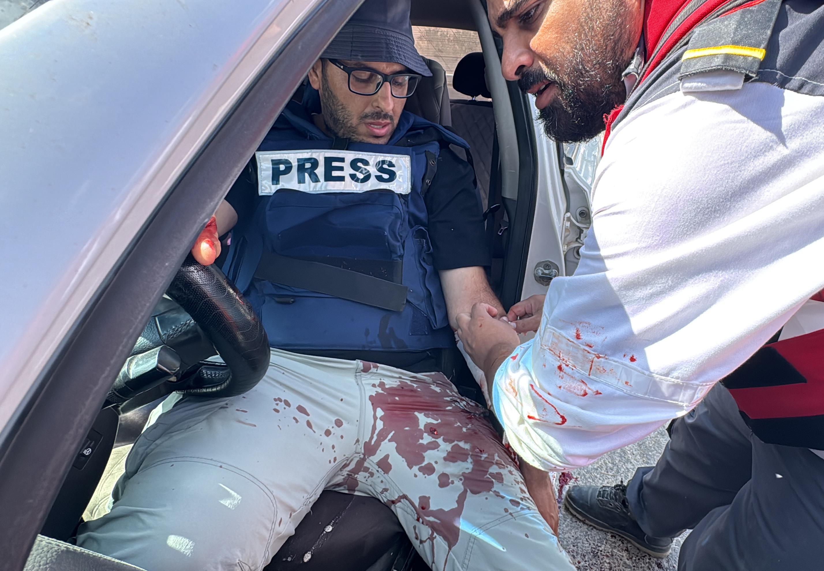 لحظة إصابة الزميل محمد منصور. (تصوير الأناضول)